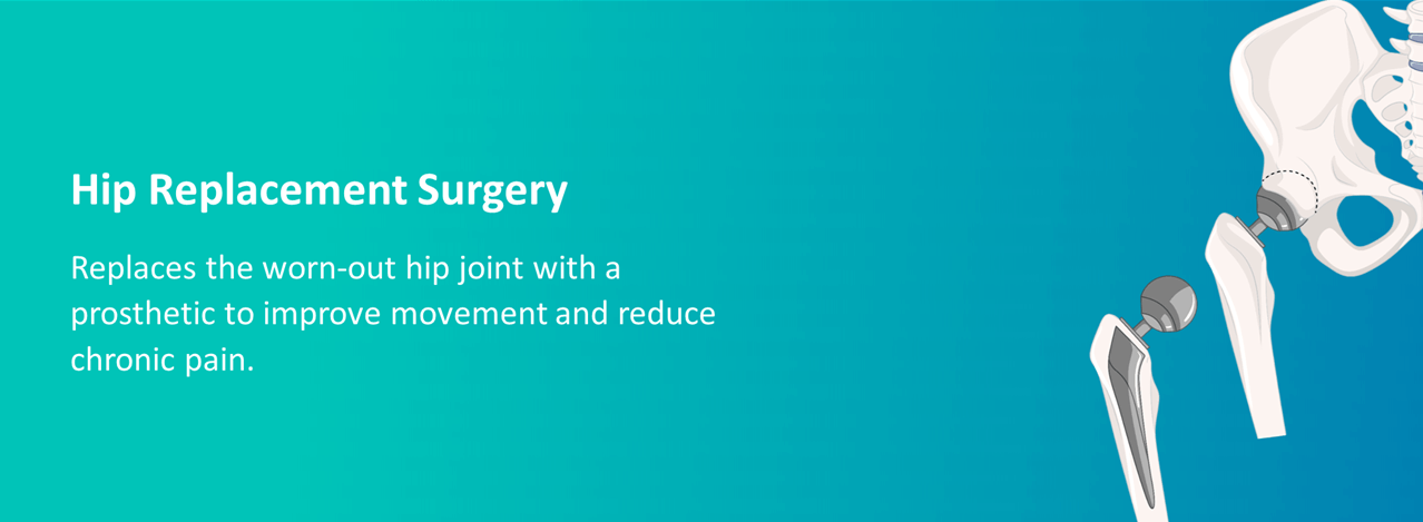 Hip Replacement Surgery - Arcus Clinic and Hospital